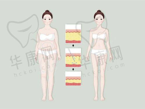 上睑凹陷填充脂肪后的辅助维持方法