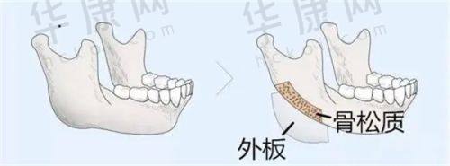 上海伯思立医疗美容沈国雄医生资质信息