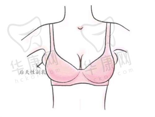 南京鼓楼美莱沈正宇隆胸2.68w元起，微创速愈打造自然饱满真胸体验