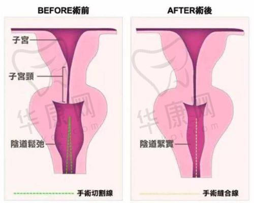 徐利刚医生预约方式