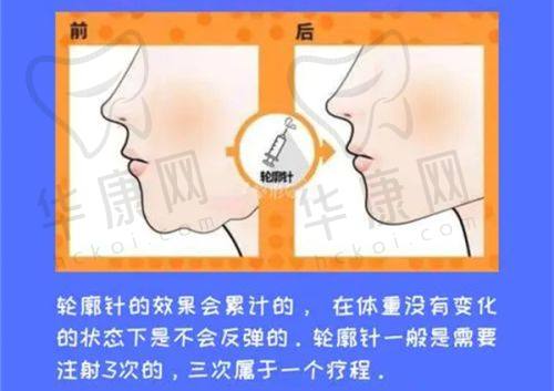 西安画美医疗美容医院张沙沙医生擅长项目