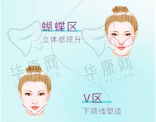 深圳鹏程医院疤痕科价格明细曝光，激光/手术祛疤及祛胎记多样项目明码标价不踩雷