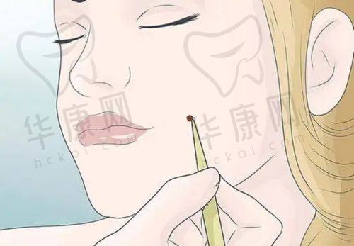 术后的护理与感受