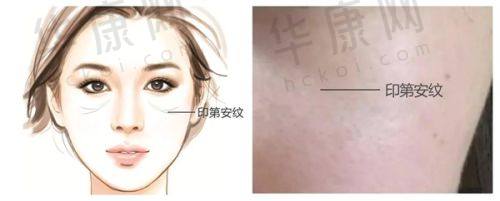 杭州艺星医疗美容医院的医生技术水平