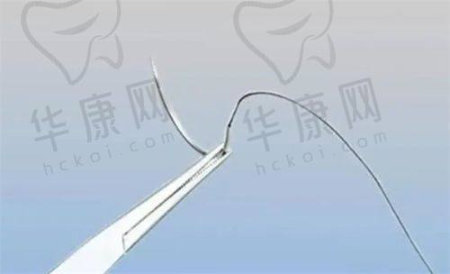 哪些因素影响提升量的确定