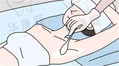 特色项目价格几何？深圳鹏程医院点阵激光等项目解析