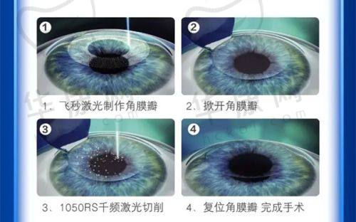 石家庄联谊眼科医院是公立的吗？非公立却技术优、费用低，值得信赖！