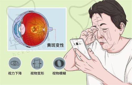 石家庄联谊眼科医院的专精实力