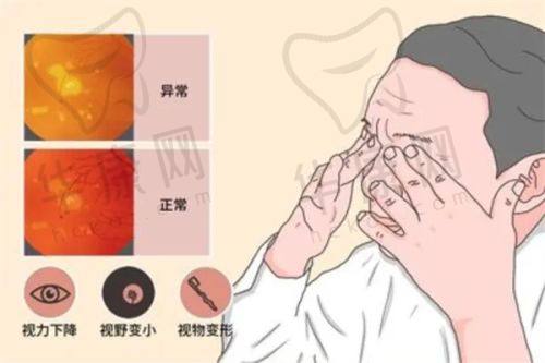 杭州飞秒秒眼科医院地址