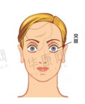 贴心术后护理与随访