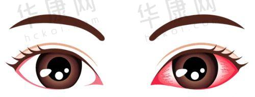 总结