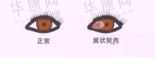 重庆铜梁爱尔眼科医院的正规性与特色