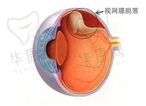 杭州飞秒秒眼科医院价格