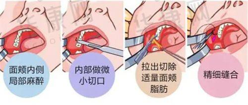 嘉兴韩辰医疗美容门诊部可靠吗?