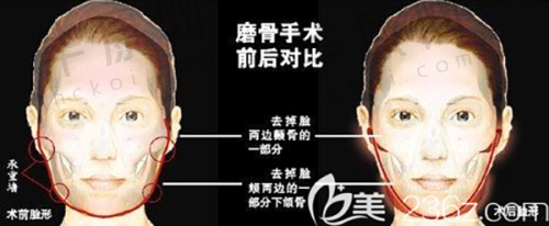 上海伯思立医疗美容沈国雄医生的口碑评价