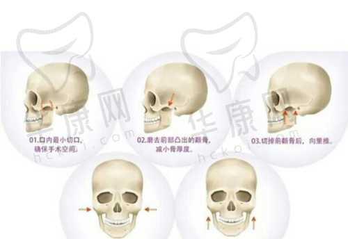 2500 毛囊单位植发价格是否合理？