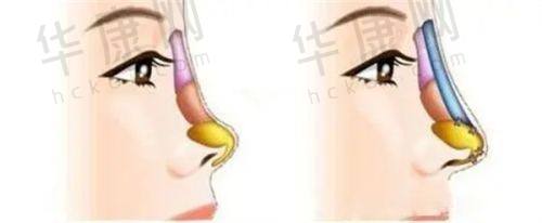 西安画美其他项目价目与亮点