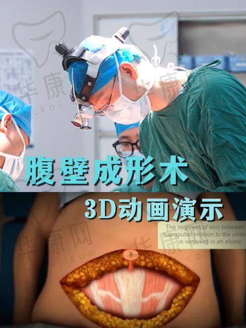 贴心的术后护理