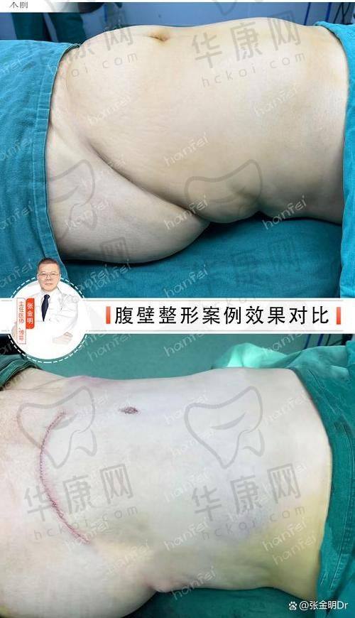高昂价格背后的价值