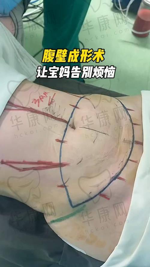 详细的术前面诊