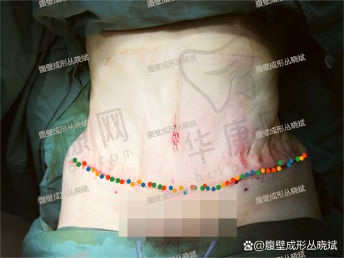 长期的跟踪服务