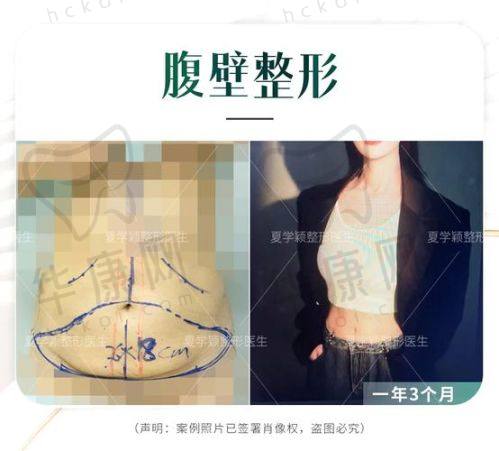 艰难的预约过程