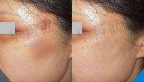 武汉艺星医疗美容的网友口碑如何?