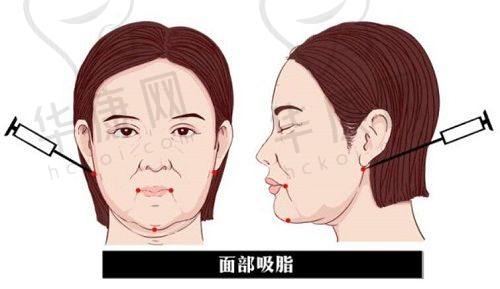泰州丽都医疗美容医院在眼综合项目上的特色优势