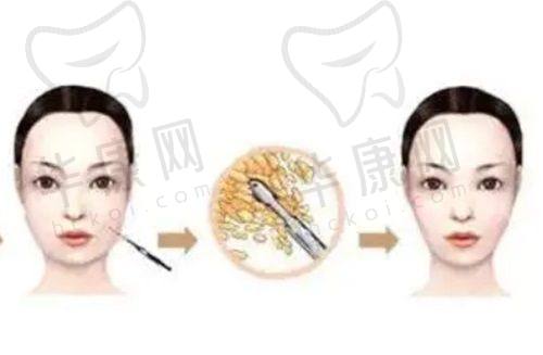 邯郸卫校附属医院皮肤科在线预约挂号：多平台覆盖是否操作便捷？