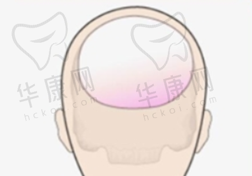 诊疗成效：自然美观的蜕变