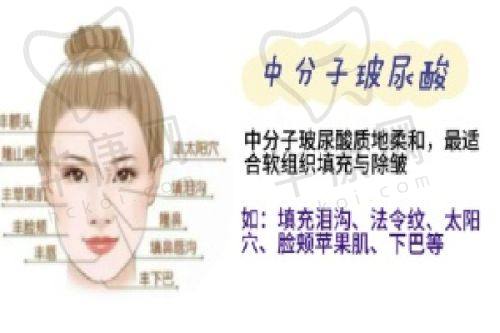 长沙美莱医疗美容医院文婷医生擅长项目