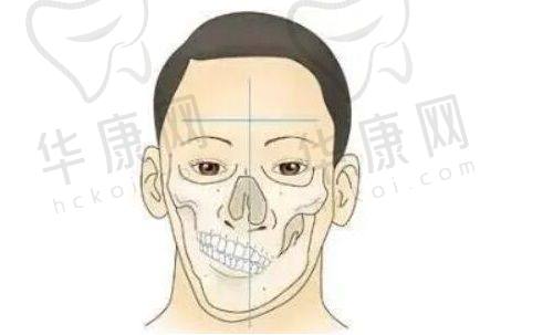 付国友医生拉皮手术价格贵吗?