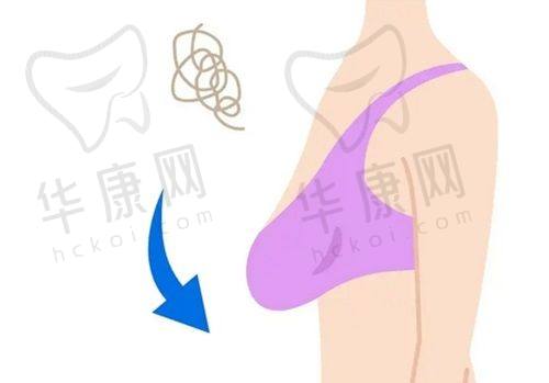 术后修复情况