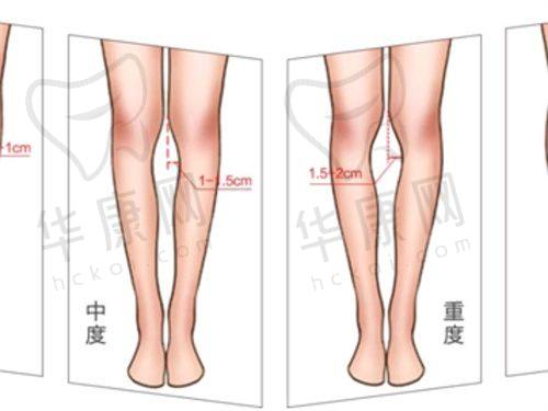 生长因子隆鼻取出的风险有哪些?