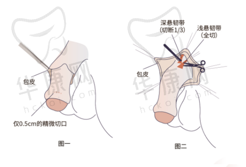 南宁华美医疗美容医院赵广生医生特色技术优势
