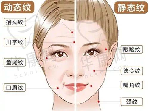 兰大一院整形科2025价格表公布：开眼角3000元起、鼻骨内推8000元起、厚唇改薄4000元起，助你安心变美