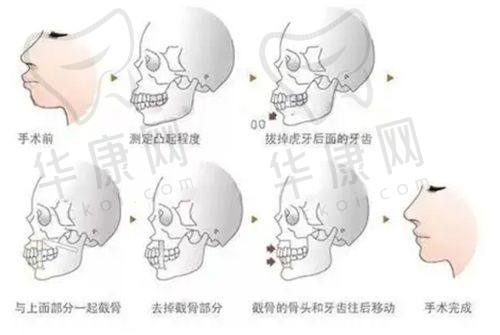 沈阳友谊美容医院的手术细节