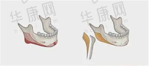 邯郸卫校附属医院皮肤科挂号有哪些常见问题与注意事项？