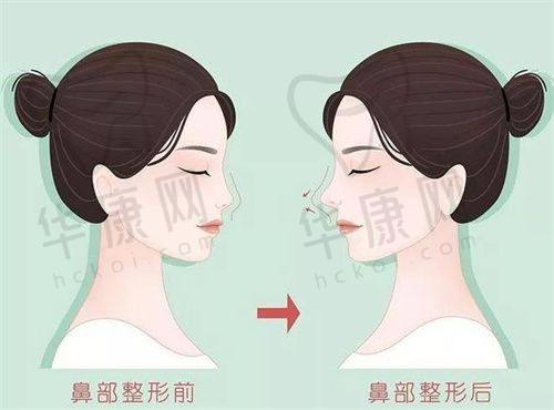 武汉艺星医疗美容的技术特色有哪些?