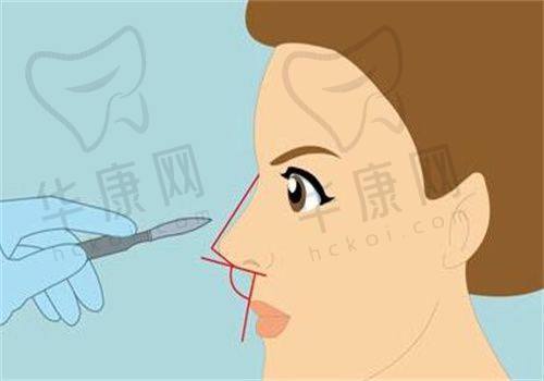 辽宁杏林整形外科医院刘建波吸脂的技术特色