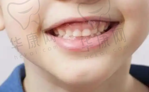 合肥瑶海松丰口腔的综合评价
