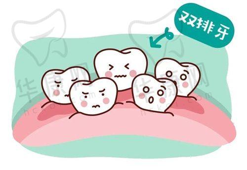 成都高新橙奕思迈口腔全口活动义齿假牙仅需7980元，正规靠谱体验佳！