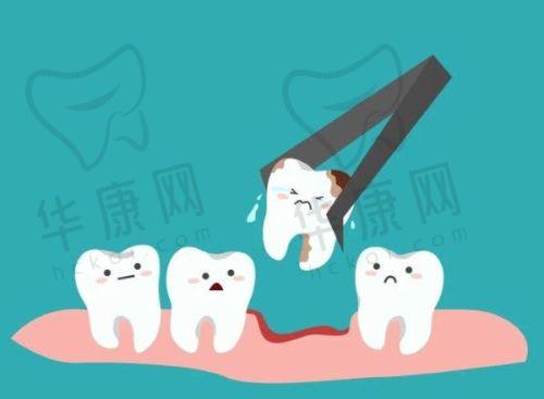 南通海门沪牙卫士口腔医院半口树脂牙贴面的成效与口碑
