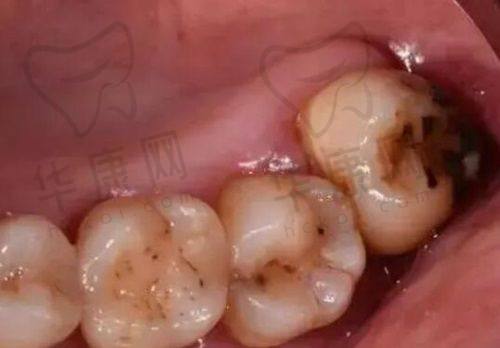 治疗项目多样性