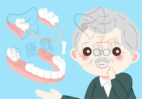 成都高新橙奕思迈口腔全口活动义齿假牙的市场反馈