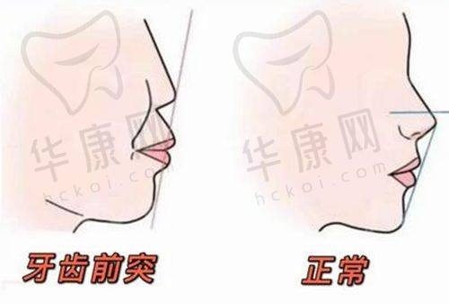 北京京植口腔镶牙及相关项目价格如何？
