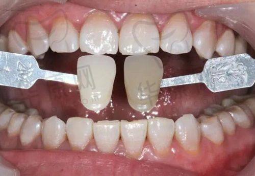 珠海六和口腔种牙有什么特色？