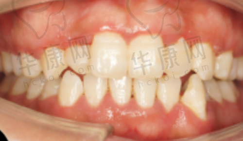 嘉兴桐乡松丰口腔门诊部殷广斌医生预约方式