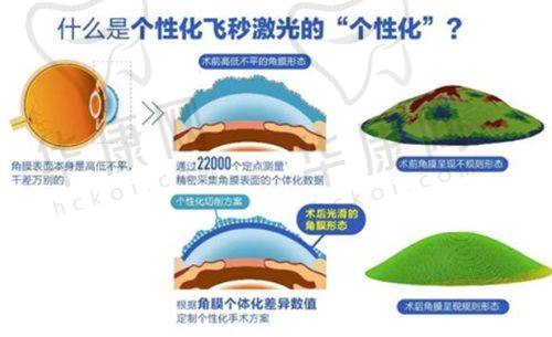 武汉普瑞眼科医院