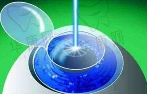 兰大二院眼科现场预约挂号适合哪些人？
